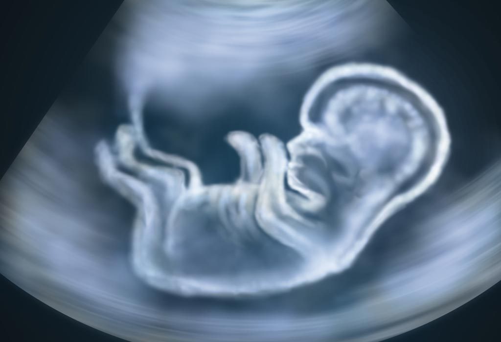 Ultrasound scan of baby