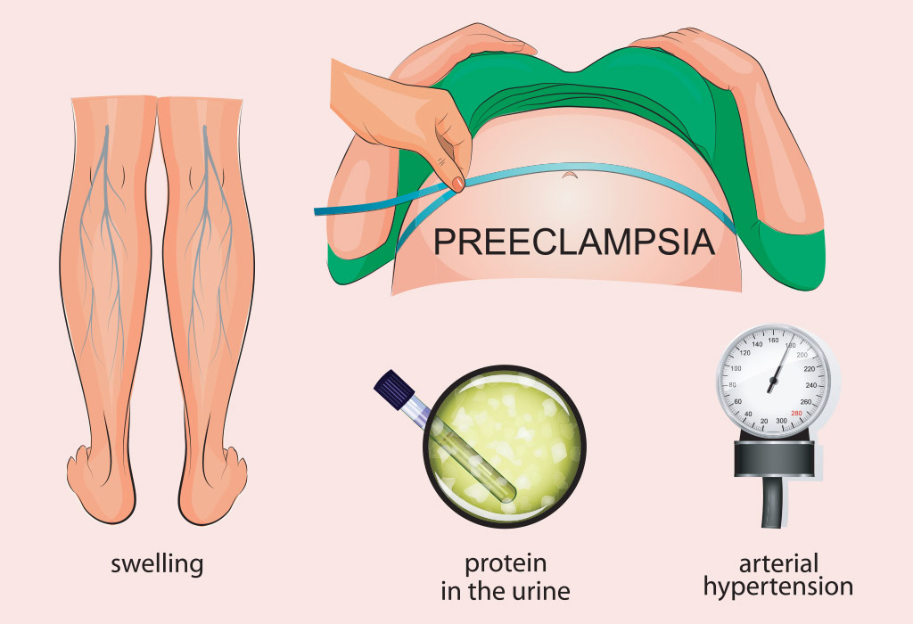 high-blood-pressure-hypertension-during-pregnancy