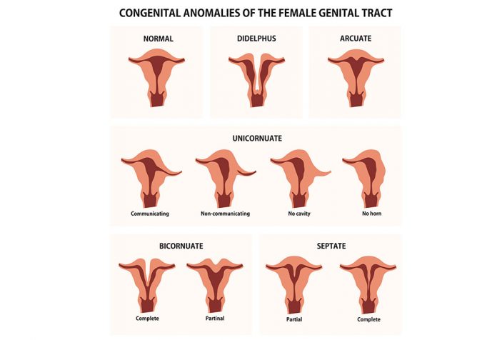type of vagina shapes