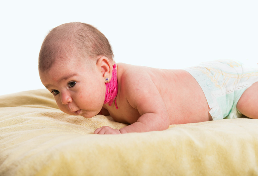 Could My Baby Develop Torticollis?