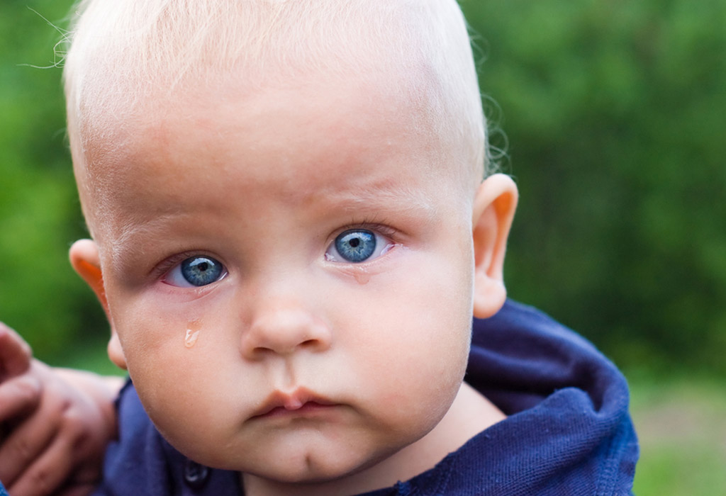 Watery Eyes in Infants Causes, Treatment and more