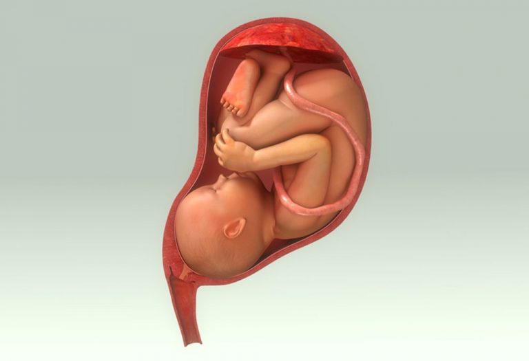 Different Placental Locations During Pregnancy
