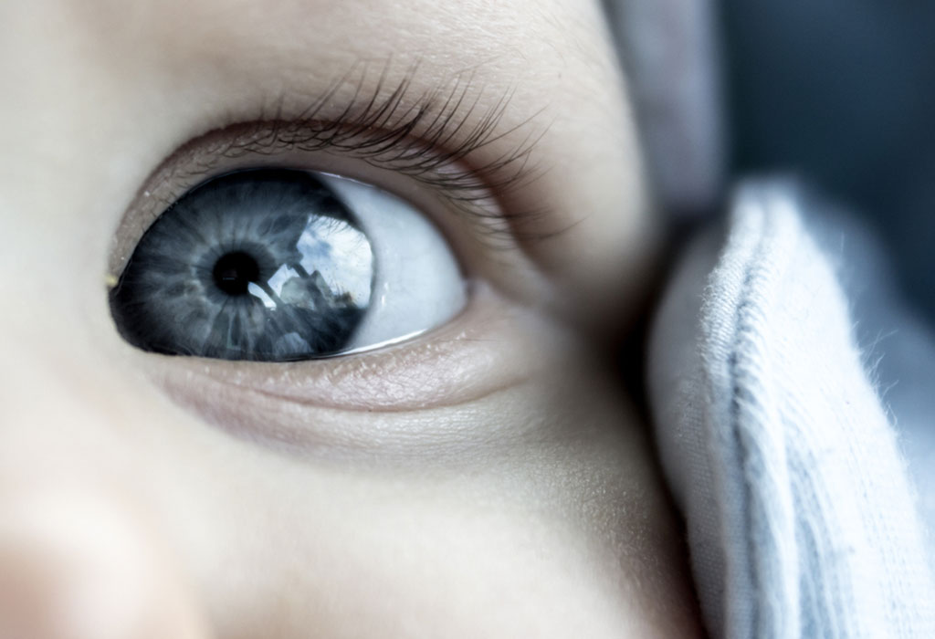 Congenital Nystagmus in Infants Reasons,Symptoms & Treatment