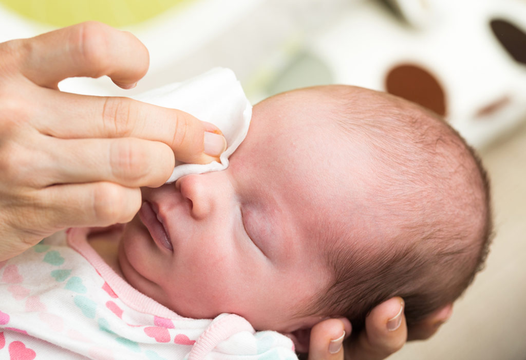 newborn-sticky-eye-causes-signs-treatment-prevention