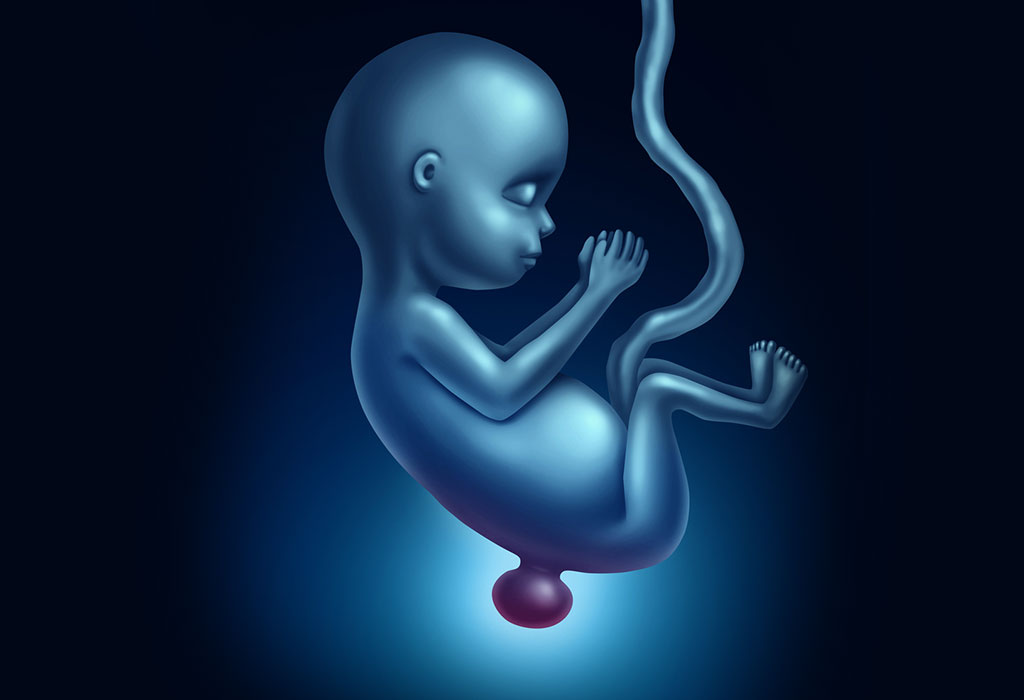 Neural tube defects types causes symprtoms treatment