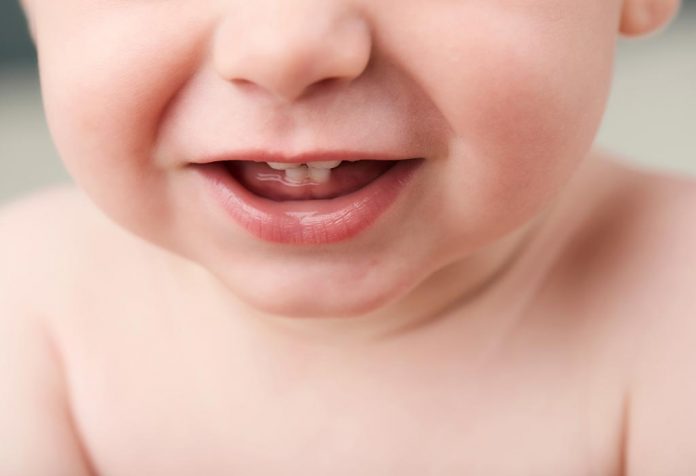 A baby showing its first few teeth
