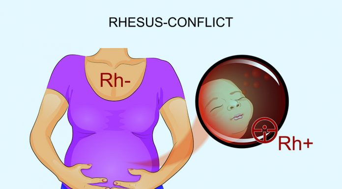 Illustration of Rh-conflict in a pregnant mother