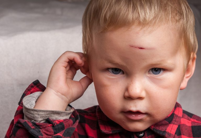 head-injury-in-children-types-symptoms-treatment