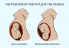 BABY'S POSITIONS IN WOMB