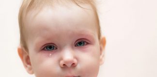 Top 10 Home Remedies for Baby Eye Infection