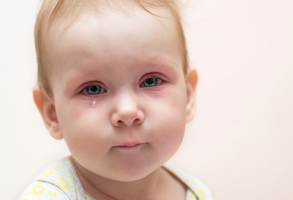 10-effective-home-remedies-for-eye-infections-in-babies