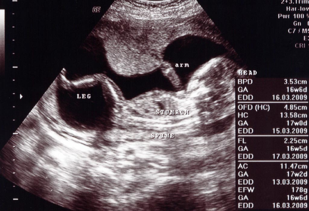 prenatal visit at 16 weeks