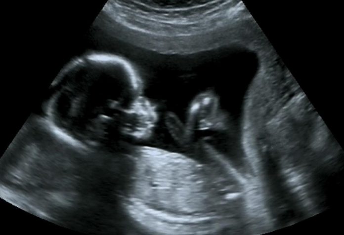 19 WEEKS PREGNANT ULTRASOUND