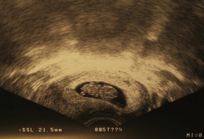 8 weeks ultrasound scan