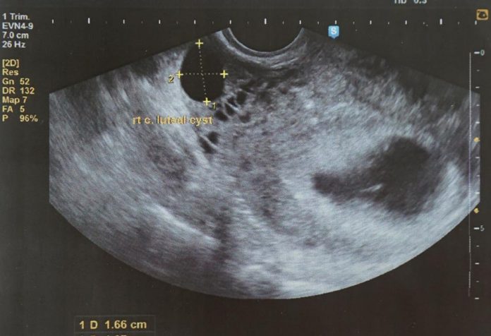 An ultrasound scan