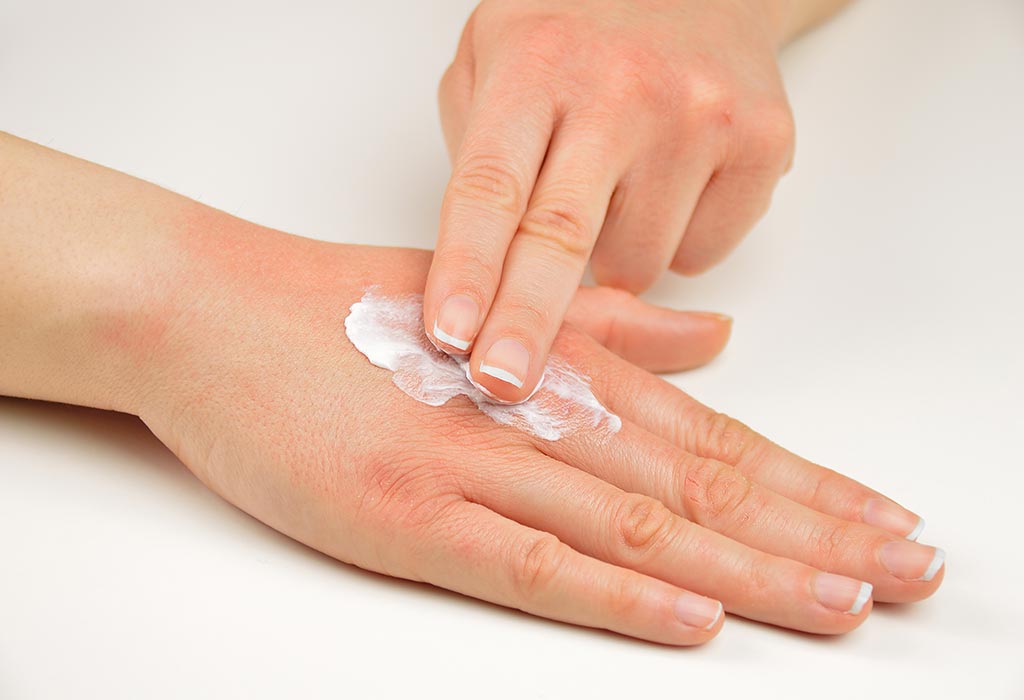 Psoriasis during Pregnancy Symptoms, Complications & Treatment