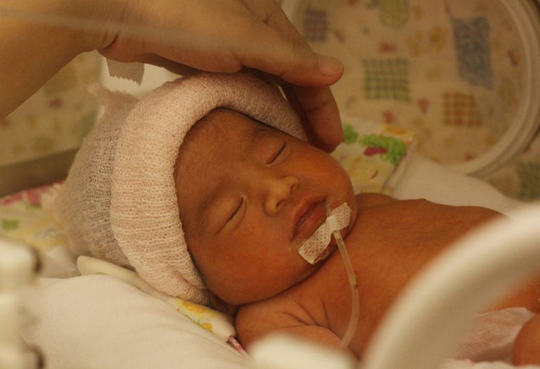 Do Babies Born At 34 Weeks Need Nicu