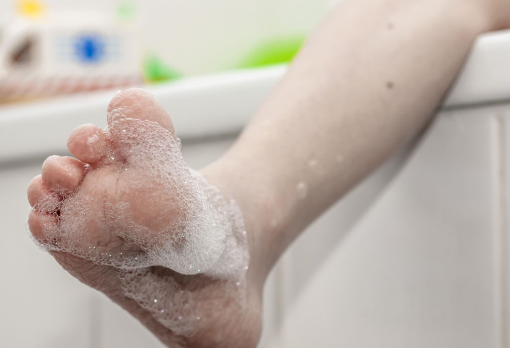 Hair Tourniquet in Babies Causes, Home Remedies & Prevention