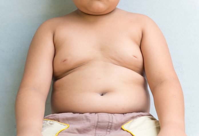 An overweight child