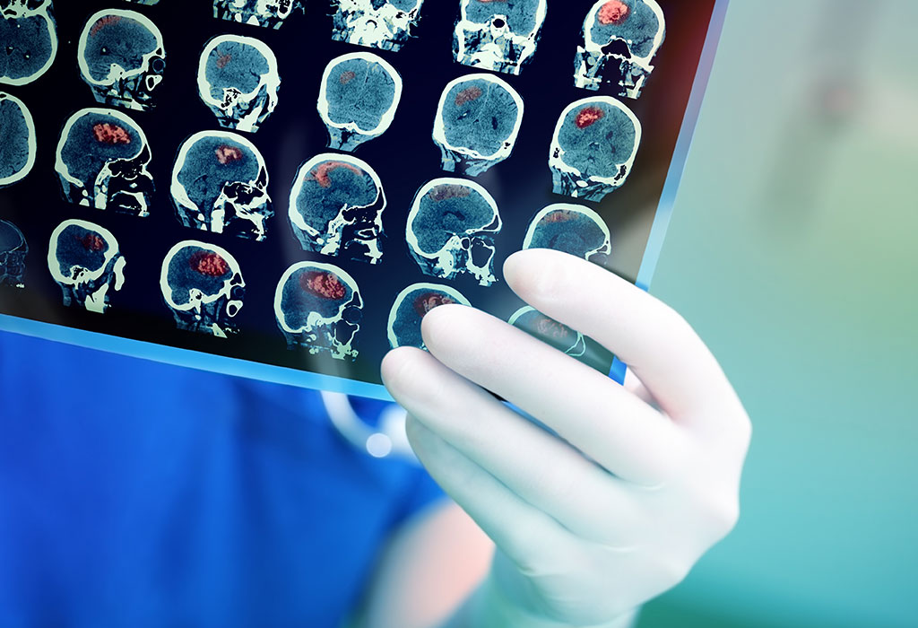 CT Scan during Pregnancy Risks and Sid Effects