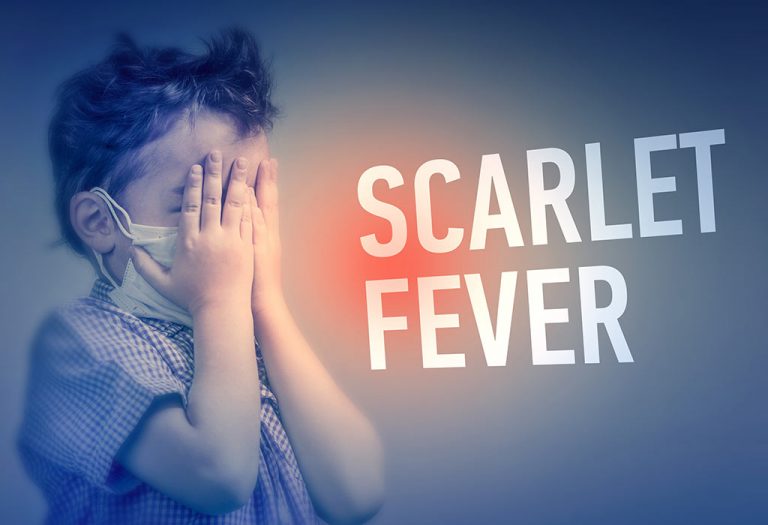 scarlet-fever-in-babies-toddlers-causes-signs-treatment