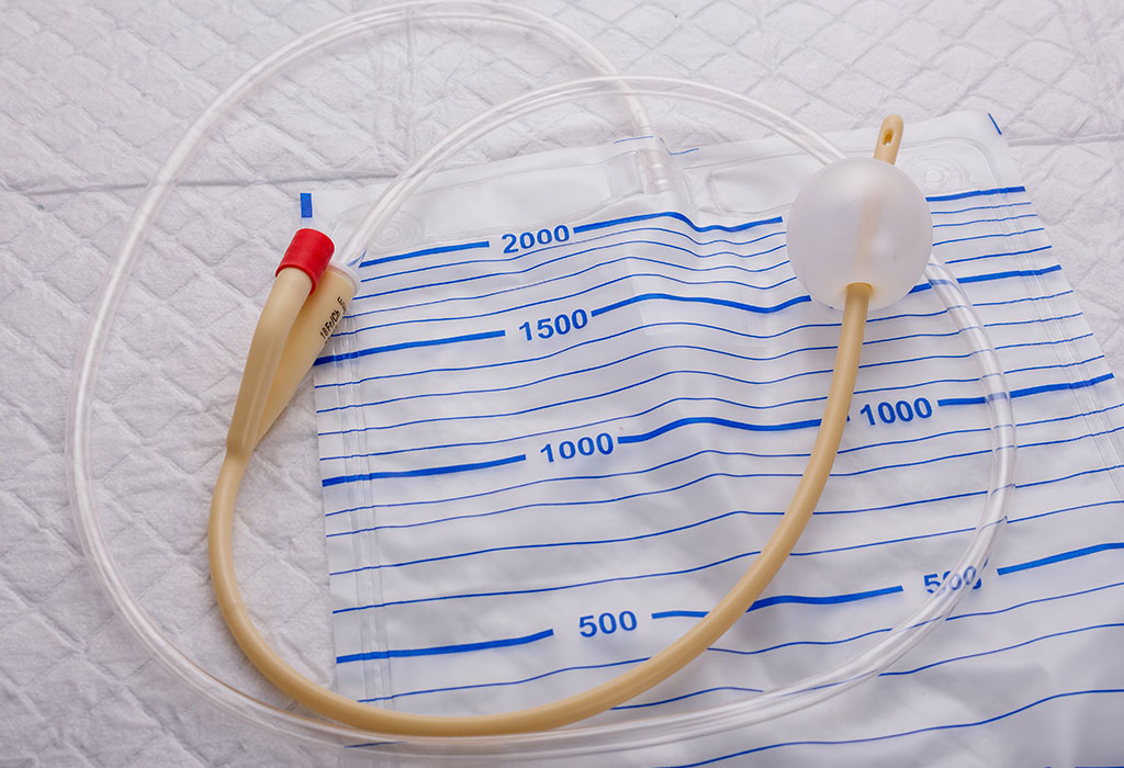 Using Foley Bulb for Labour Induction Benefits, Procedure