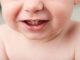 Teething in Toddler - Symptoms & Remedies