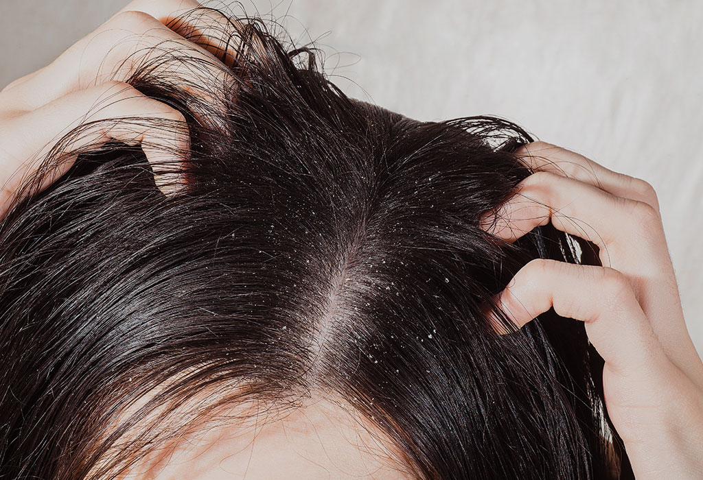 Scalp Problems in Kids Causes, Symptoms & Treatment